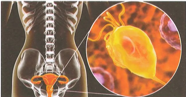 Figura 4 de Ciencias Naturales · 9 EGB · 2024