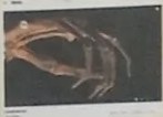 Ilustración de la articulación de la rodilla con fémur, tibia y rótula.