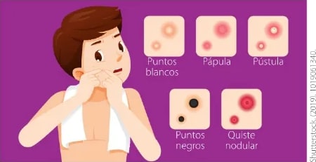 Figura 1 de Ciencias Naturales · 6 EGB · 2025