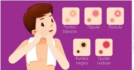 Figura 2 de Ciencias Naturales · 6 EGB · 2025