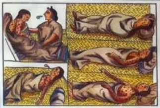 Ilustración del s. XVI mostrando indígenas con viruela.